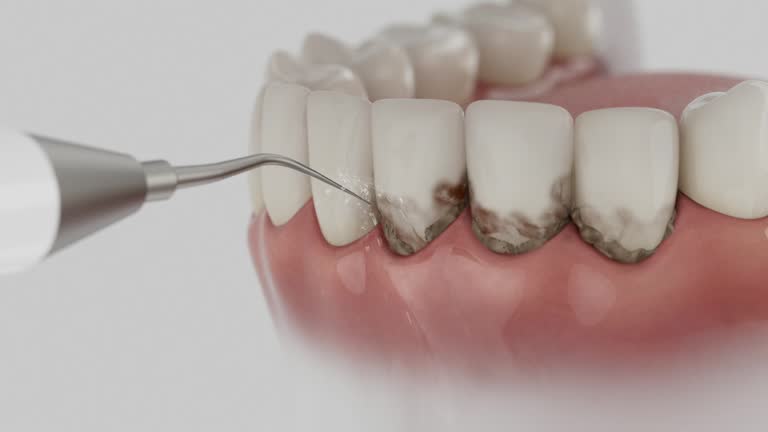 Reliable Invisalign Clear Aligners contractor in Omaha, TX by Smile Center Dentistry